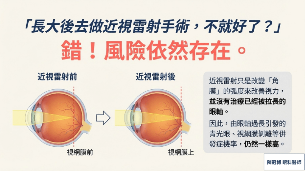 Laser does not cure myopia complications